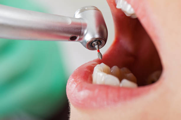 Best Cosmetic Emergency Dentistry in Mint Hill, NC